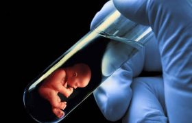 Cost of IVF in Nigeria