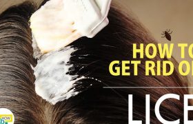 Will Relaxer Kill Head Lice