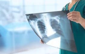 Radiography Vs Nursing Salary in the UK